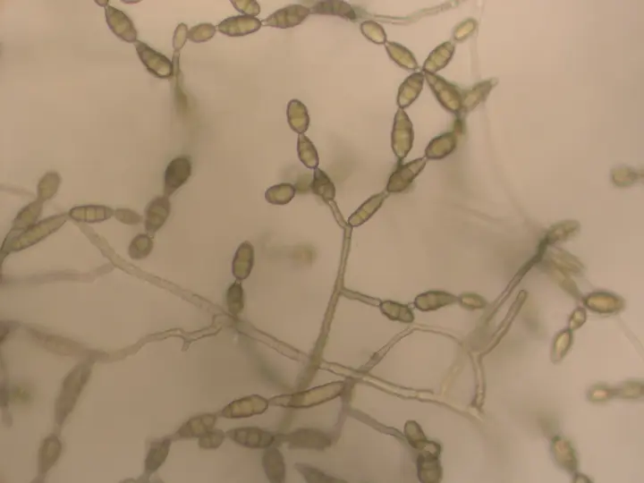 Mikroskopaufnahme von Pilzfäden mit keulenförmigen, gekammerten Sporen von Alternaria alternata
